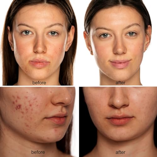 Máscara LED de belleza - Máscara facial de terapia de luz roja y luz infrarroja para arrugas - Luz azul para el acné - Longitud de onda múltiple para el cuidado de la piel - Recargable para uso