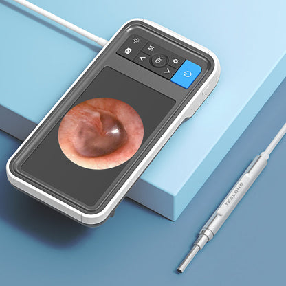 TESLONG Otoscopio digital MS450D39 con pantalla: el mejor otoscopio digital para uso doméstico