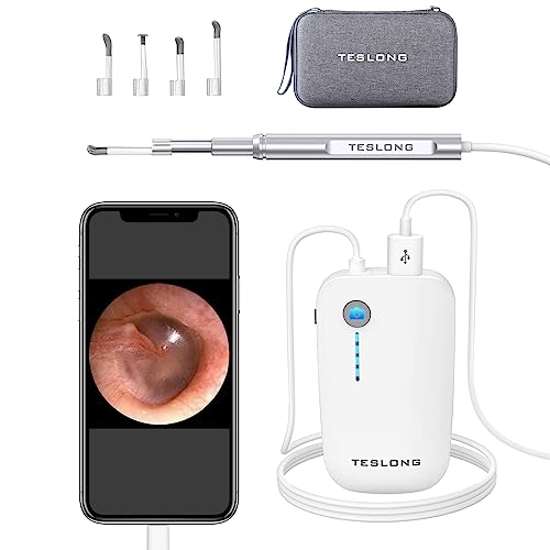Teslong Teslong - Otoscopio digital con removedor de cera de oído, cámara de oído con herramientas de eliminación de cera de oído, otoscopio de video con luz para iPhone, iPad, teléfono Android, USB, púas de oído, impermeable, 1080p HD