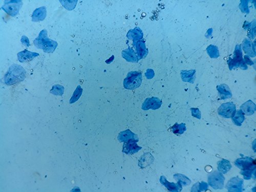 ioLight Microscopio de alta resolución de 0.039 in Product 1-1mm